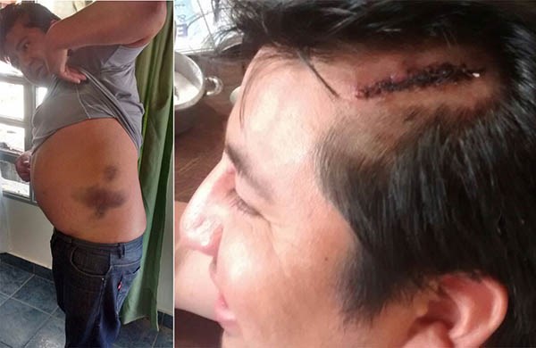 Crudos testimonios de las golpizas a las que fueron sometidos algunos vecinos por parte de la policía.