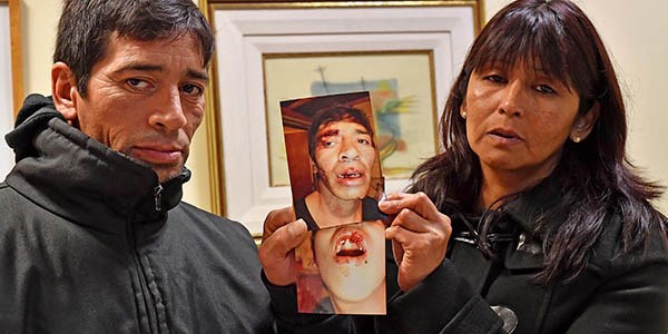 Rodolfo Arriagada y su mujer, Raquel Torres, con las fotos que les sacaron tras la golpiza policial en 2014.