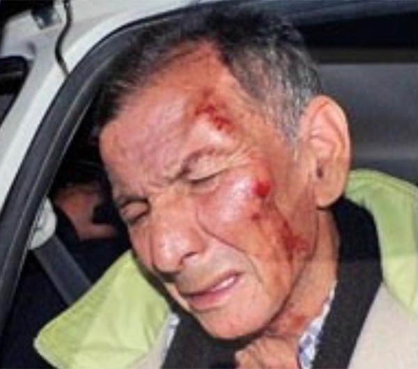 Lencinas, con gestos de dolor tras ser golpeado. (Foto: Radio 3)