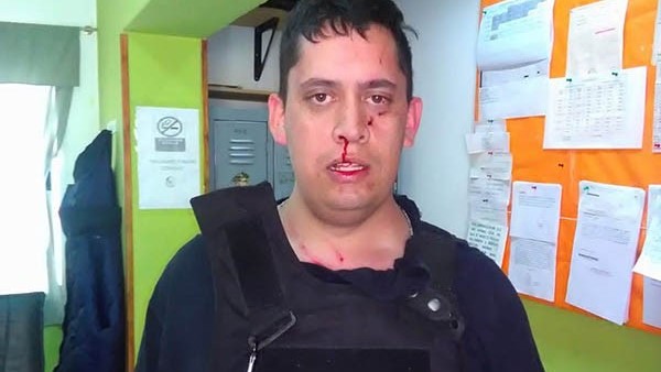 Así le dejaron la cara al Policía que intentó poner en orden la situación