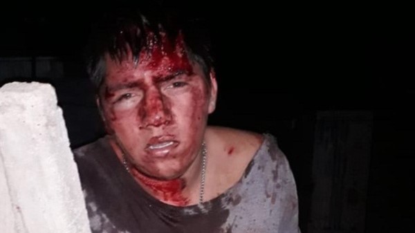 La víctima quedó ensangrentada pero pese al incidente, se recupera.