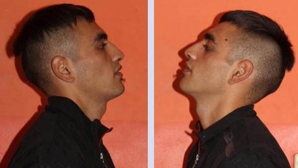 Águila había sido condenado por asaltar a turistas en laguna la Zeta.