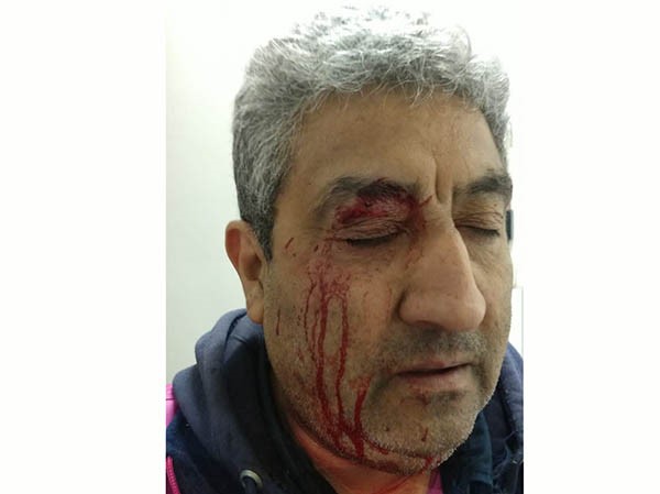 El playero de 53 años muestra el salvaje ataque de un remisero local.
