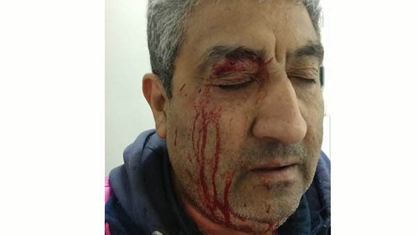 El playero de 53 años muestra el salvaje ataque de un remisero local.