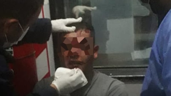 El agresor de su exmujer reponiéndose de las heridas en su rostro.