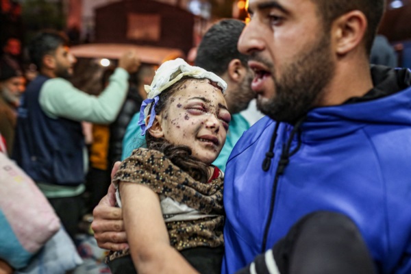 Palestinos heridos evacuados del hospital de Indonesia, en el norte de la Franja de Gaza, reciben atención en el hospital Nasser.