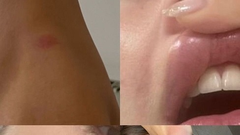 La víctima es su pareja Ludmila, quien pidió ayuda a través de las redes y solicita una ‘medida cautelar’ urgente.